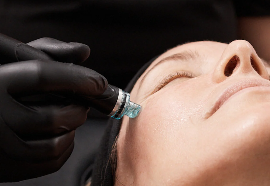 hydra facial treatment Patna