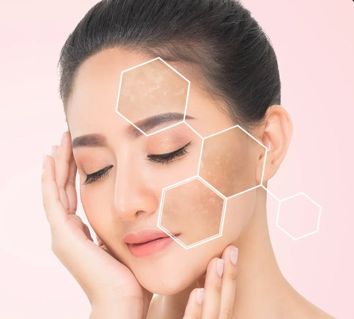 pigmentation treatment in Patna